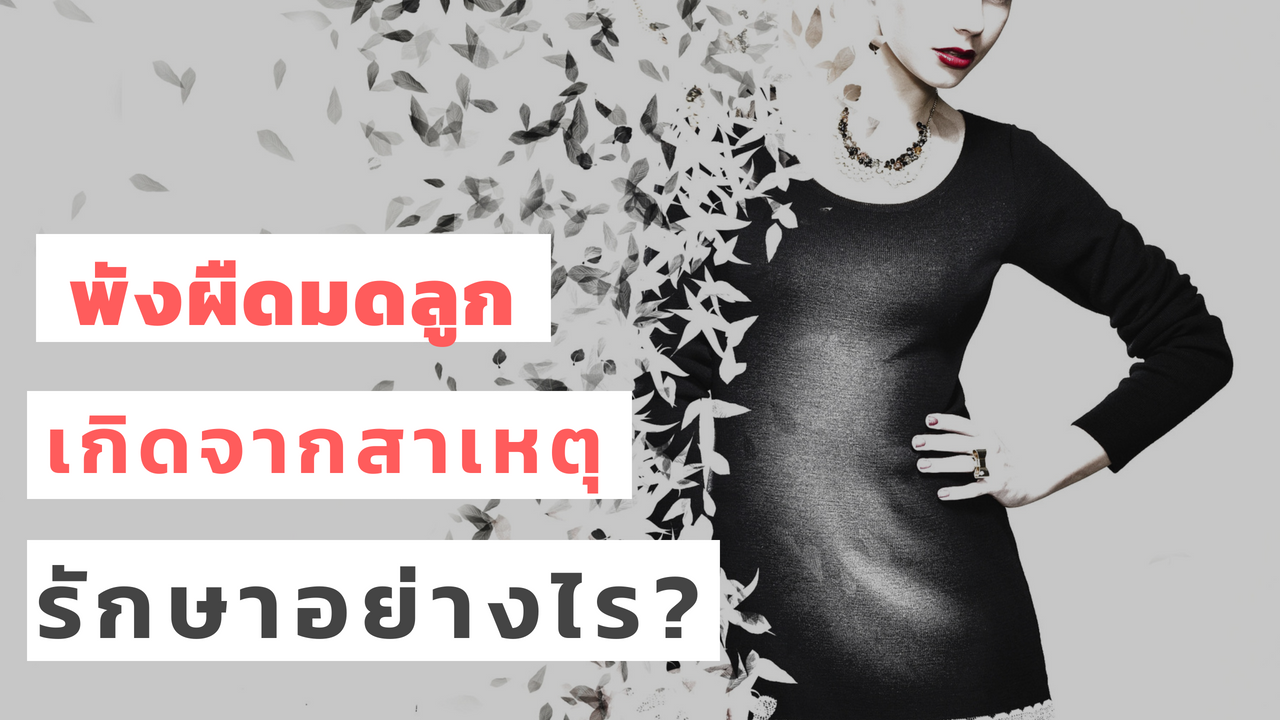 พังผืดมดลูก